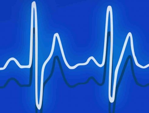 Low Intensity Cardio Workouts